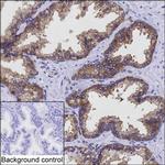PAK4 Antibody in Immunohistochemistry (Paraffin) (IHC (P))