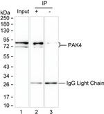 PAK4 Antibody in Immunoprecipitation (IP)