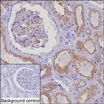 HIP1R Monoclonal Antibody (K1E009_9H2)