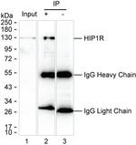 HIP1R Antibody in Immunoprecipitation (IP)