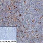 NAGK Monoclonal Antibody (K1E005_8G12)