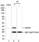 NAGK Antibody in Immunoprecipitation (IP)