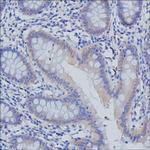 PDE5 Monoclonal Antibody (K1E005_13D12)