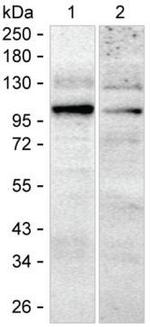 PDE5 Antibody in Western Blot (WB)