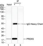PRDX5 Antibody in Immunoprecipitation (IP)