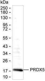 PRDX5 Antibody in Western Blot (WB)