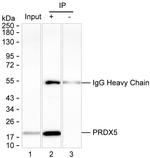 PRDX5 Antibody in Immunoprecipitation (IP)