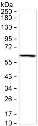 Cytokeratin 4 Antibody in Western Blot (WB)