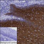 Cytokeratin 6A Monoclonal Antibody (K06323_15F4)