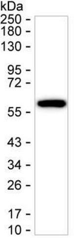 Cytokeratin 6A Antibody in Western Blot (WB)