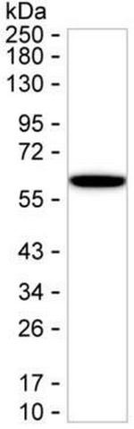 Cytokeratin 6A Antibody in Western Blot (WB)