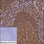 HLA-DRA Monoclonal Antibody (KAA312_15E9)