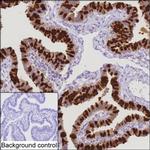 CAPS Monoclonal Antibody (K49040_2C5)