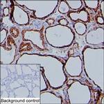 MDA5 Monoclonal Antibody (K49007_14H10)
