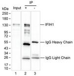 MDA5 Antibody in Immunoprecipitation (IP)