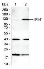 MDA5 Antibody in Western Blot (WB)