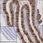 AGR3 Monoclonal Antibody (K1E028_18C10)