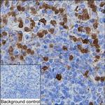 CDA Monoclonal Antibody (K1E006_15H12)