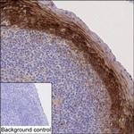 FGFBP1 Monoclonal Antibody (KAA123_3F10)