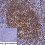 NTAL Monoclonal Antibody (K52022_7A12)