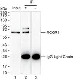 RCOR1 Antibody in Immunoprecipitation (IP)