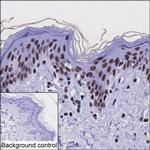 EXOSC10 Monoclonal Antibody (K29029_4G9)