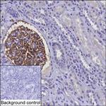 CD142 Monoclonal Antibody (K06319_4H12)