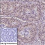 THOC6 Monoclonal Antibody (KAA134_2H5)