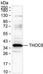 THOC6 Antibody in Western Blot (WB)
