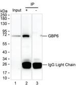 GBP6 Antibody in Immunoprecipitation (IP)