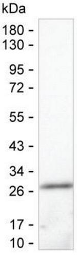 GSTP1 Antibody in Western Blot (WB)
