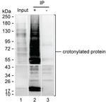 Crotonylated Lysine Antibody in Immunoprecipitation (IP)