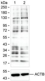 Lactyl Lysine Monoclonal Antibody (K16286_4E11)