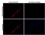 STS Recombinant Rabbit Monoclonal Antibody (PSH05-74)