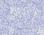 STS Antibody in Immunohistochemistry (Paraffin) (IHC (P))