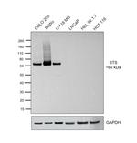 STS Antibody in Western Blot (WB)
