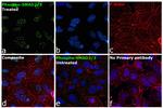 Phospho-SMAD2/SMAD3 (Ser465, Ser467, Ser423, Ser425) Recombinant Rabbit Monoclonal Antibody (ST0493)