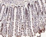 Phospho-SMAD2/SMAD3 (Ser465, Ser467, Ser423, Ser425) Antibody in Immunohistochemistry (Paraffin) (IHC (P))