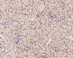 Phospho-SMAD2/SMAD3 (Ser465, Ser467, Ser423, Ser425) Antibody in Immunohistochemistry (Paraffin) (IHC (P))