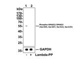 Phospho-SMAD2/SMAD3 (Ser465, Ser467, Ser423, Ser425) Antibody in Western Blot (WB)