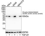 Phospho-SMAD2/SMAD3 (Ser465, Ser467, Ser423, Ser425) Antibody in Western Blot (WB)