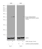 Phospho-SMAD2/SMAD3 (Ser465, Ser467, Ser423, Ser425) Antibody in Western Blot (WB)
