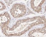 PRMT4 Antibody in Immunohistochemistry (Paraffin) (IHC (P))
