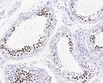 KIFC1 Antibody in Immunohistochemistry (Paraffin) (IHC (P))