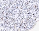 KIFC1 Antibody in Immunohistochemistry (Paraffin) (IHC (P))