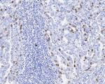 KIFC1 Antibody in Immunohistochemistry (Paraffin) (IHC (P))