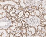 TOMM22 Antibody in Immunohistochemistry (Paraffin) (IHC (P))