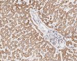TOMM22 Antibody in Immunohistochemistry (Paraffin) (IHC (P))