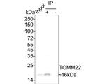 TOMM22 Antibody in Immunoprecipitation (IP)