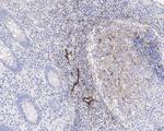 CXCL13 Antibody in Immunohistochemistry (Paraffin) (IHC (P))